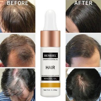Копър за естествения растеж на косата, загуститель, Серум за възстановяване на растежа, Копър за бърз растеж на косата, Билкови лечение на Загубата на коса, Грижа за кожата на главата